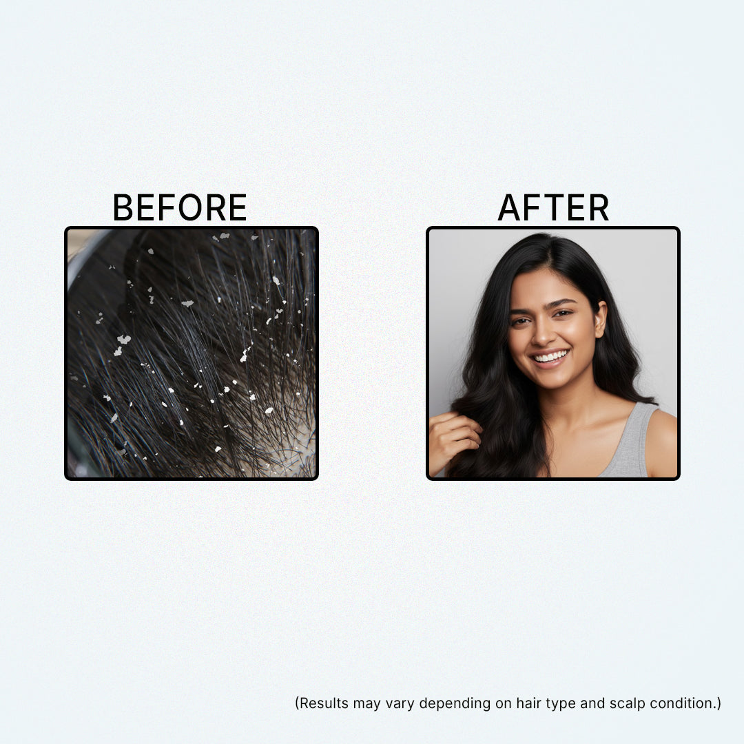 Deewal Anti-Dandruff Oil