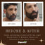 Beard Black & Mooch Oil – Combo - Deewal - Herbal Beauty and Health Products
