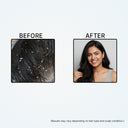 Deewal Anti-Dandruff Oil