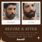 Beard Black & Mooch Oil – Combo - Deewal - Herbal Beauty and Health Products