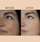 Deewal Tea Tree Serum – Anti-Acne - Deewal - Herbal Beauty and Health Products